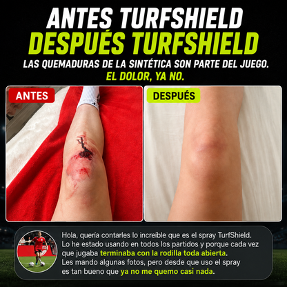 TurfShield™ Protector Anti-Roce para Cancha Sintética - Paga 1 Lleva 2